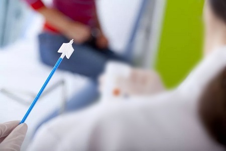 Những tiến bộ trong sàng lọc ung thư cổ tử cung: Vai trò của các xét nghiệm HPV tự thu thập