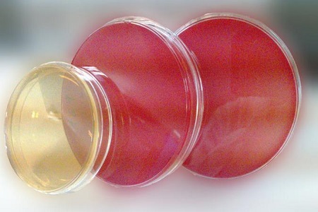 Salmonella Shigella Agar (SS): Phương tiện thiết yếu để phân lập mầm bệnh