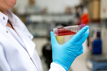 Bộ vận chuyển virus (không bị bất hoạt)-Bộ sưu tập mẫu virus an toàn