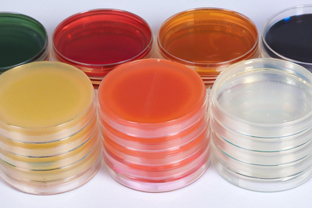 Triple Sugar Iron Agar (TSI): Sự khác biệt chính xác của trực khuẩn đường ruột với Babio