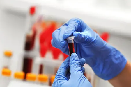 BABIO ra mắt xét nghiệm nhanh thai kỳ huỳnh quang ở bò