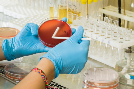 Môi trường thạch MacConkey Agar của BABIO – Phân lập chọn lọc cao cấp cho chẩn đoán vi sinh toàn cầu